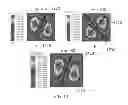 Fig. 15 - Ferrite-induced spatial modification of EM field patterns