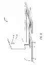 Fig. 09 - Component mounting structures with breakaway support tabs