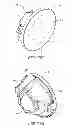 Fig. 35 - Modular optic for changing light emitting surface