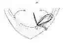 Fig. 01 - Enhanced watercraft