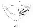 Fig. 04 - Enhanced watercraft