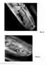 Fig. 05 - Volume rendering of 3D sonar data