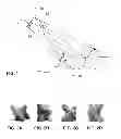 Fig. 02 - Method of object tracking using sonar imaging