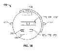 Fig. 03 - PILLBOX AND ALARM CLOCK
