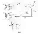 Fig. 06 - Automatic Power Adjusting Headphones