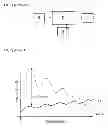 Fig. 02 - APPARATUS AND METHOD OF SHIELDING EXTERNAL NOISE FOR USE IN HEARING AID DEVICE
