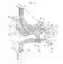 Fig. 02 - Removable attachment of a passive transcutaneous bone conduction device with limited skin deformation