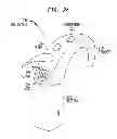 Fig. 03 - Removable attachment of a passive transcutaneous bone conduction device with limited skin deformation