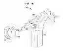 Fig. 07 - Removable attachment of a passive transcutaneous bone conduction device with limited skin deformation