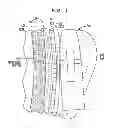 Fig. 08 - Removable attachment of a passive transcutaneous bone conduction device with limited skin deformation