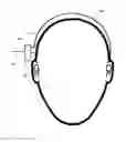 Fig. 01 - Adhesive bone conduction hearing device