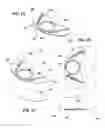 Fig. 06 - Adhesive bone conduction hearing device