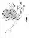 Fig. 05 - Thin Film Bone-Conduction Transducer for a Wearable Computing System