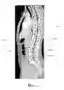 Fig. 04 - Analytic morphomics: high speed medical image automated analysis method