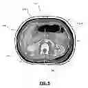 Fig. 06 - Analytic morphomics: high speed medical image automated analysis method