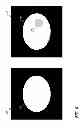 Fig. 05 - Methods and systems for determining the concentration of a contrast agent