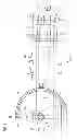 Fig. 02 - Method for generating a solid model of a heart and associated C-arm X-ray equipment