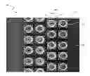 Fig. 01 - DESCRIPTOR GUIDED FAST MARCHING METHOD FOR ANALYZING IMAGES AND SYSTEMS USING THE SAME