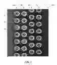 Fig. 04 - DESCRIPTOR GUIDED FAST MARCHING METHOD FOR ANALYZING IMAGES AND SYSTEMS USING THE SAME