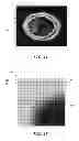 Fig. 10 - DESCRIPTOR GUIDED FAST MARCHING METHOD FOR ANALYZING IMAGES AND SYSTEMS USING THE SAME