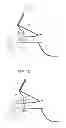 Fig. 07 - Assembly of an axial turbomachine and method for manufacturing an assembly of this type