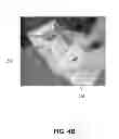 Fig. 04 - Method for radiation sterilization of medical devices
