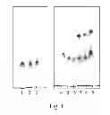 Fig. 02 - Halogenated di- and trisaccharides, pharmaceutical formulations, diagnostic kits and methods of treatment