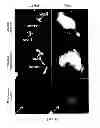 Fig. 07 - Materials and Methods Relating to Cardiovascular Imaging