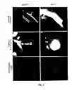 Fig. 08 - Materials and Methods Relating to Cardiovascular Imaging