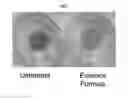 Fig. 03 - DICKKOPF-1 expression modulating compositions and uses thereof