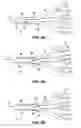 Fig. 04 - Compositions for achieving a therapeutic effect in an anatomical structure