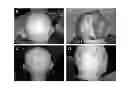 Fig. 01 - Methods for treating hair loss disorders