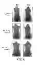 Fig. 46 - Methods for treating hair loss disorders
