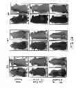 Fig. 49 - Methods for treating hair loss disorders