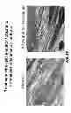 Fig. 65 - Methods for treating hair loss disorders