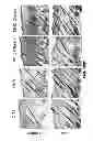 Fig. 77 - Methods for treating hair loss disorders
