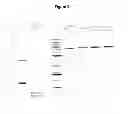 Fig. 03 - Treatment method for microbial infection