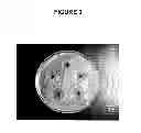 Fig. 04 - Treatment method for microbial infection