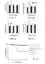 Fig. 03 - Agents that reduce neuronal overexcitation
