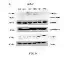 Fig. 07 - Prostate carcinogenesis predictor