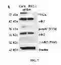 Fig. 08 - Prostate carcinogenesis predictor