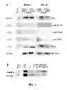Fig. 09 - Prostate carcinogenesis predictor