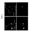 Fig. 02 - PERFLUORINATED COMPOUNDS FOR THE NON-VIRAL TRANSFER OF NUCLEIC ACIDS