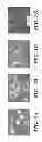 Fig. 02 - NEURAL STEM CELLS DERIVED FROM INDUCED PLURIPOTENT STEM CELLS