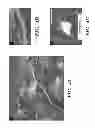 Fig. 09 - NEURAL STEM CELLS DERIVED FROM INDUCED PLURIPOTENT STEM CELLS