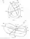 Fig. 03 - Osteoinductive demineralized cancellous bone