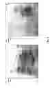 Fig. 03 - METHOD FOR PARTIAL DEGRADATION OF GLUTEN