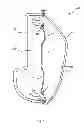 Fig. 02 - SPACING DEVICE FOR STACKING IDENTICALLY SHAPED PLASTIC MOLDED PARTS