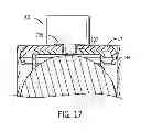 Fig. 17 - System and method for closing a battery fill hole