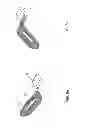 Fig. 06 - Light guide type pain reliever